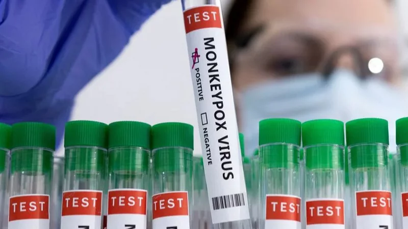 Se confirmó el primer caso de viruela del mono en Argentina