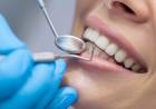 Detectan nueva bacteria que podría ser la causante de las caries