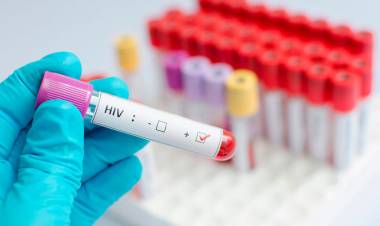 A 40 años de la aparición del VIH SIDA, la enfermedad está lejos de erradicarse