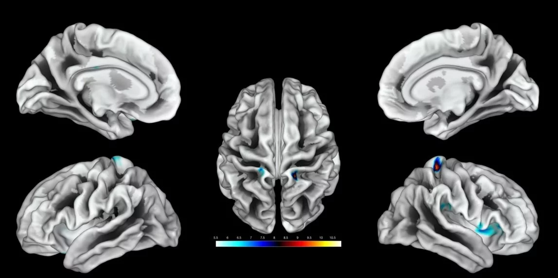 Investigadores mapean por primera vez regiones del cerebro que corresponden al clítoris